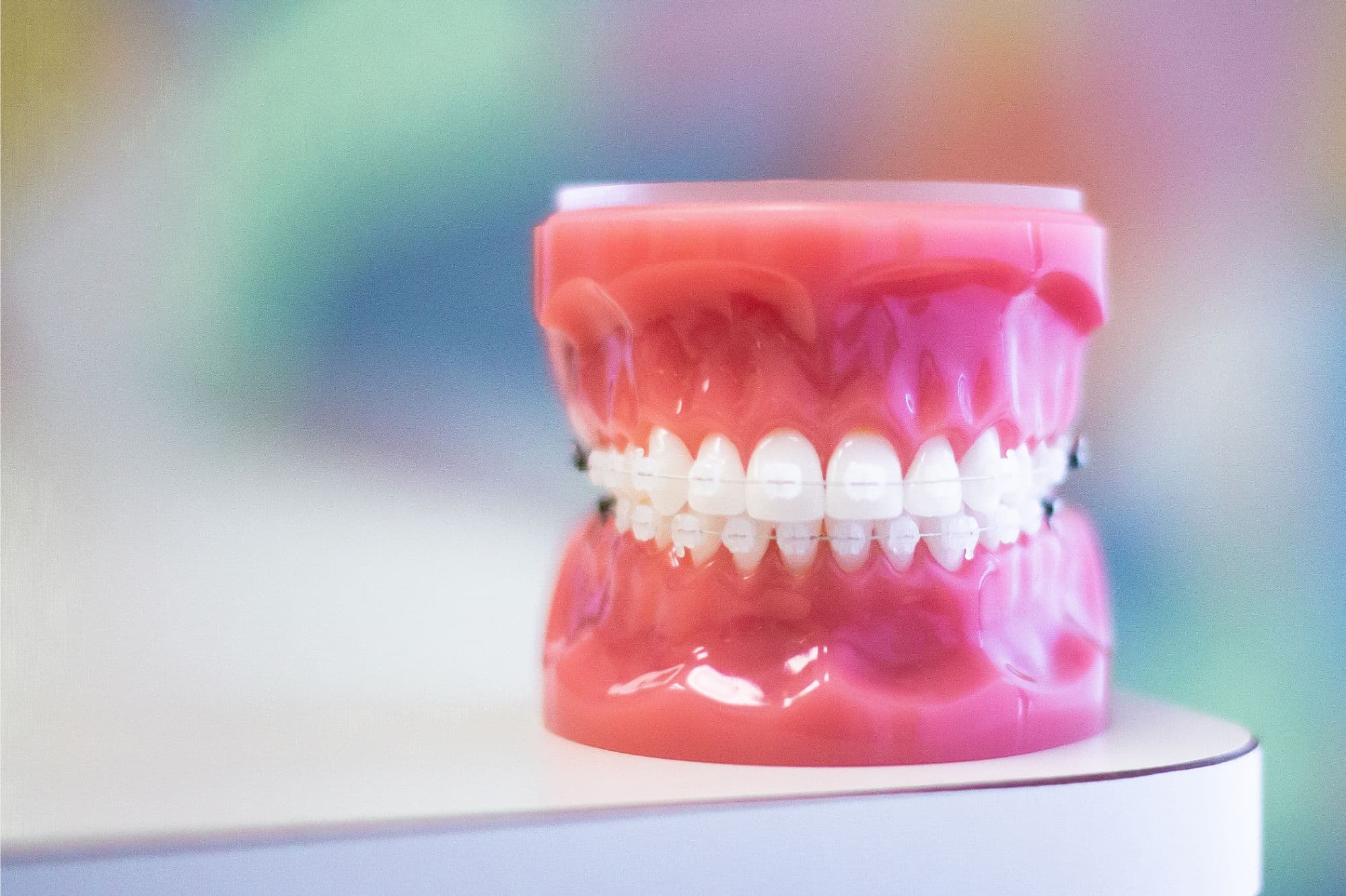 Clear Braces