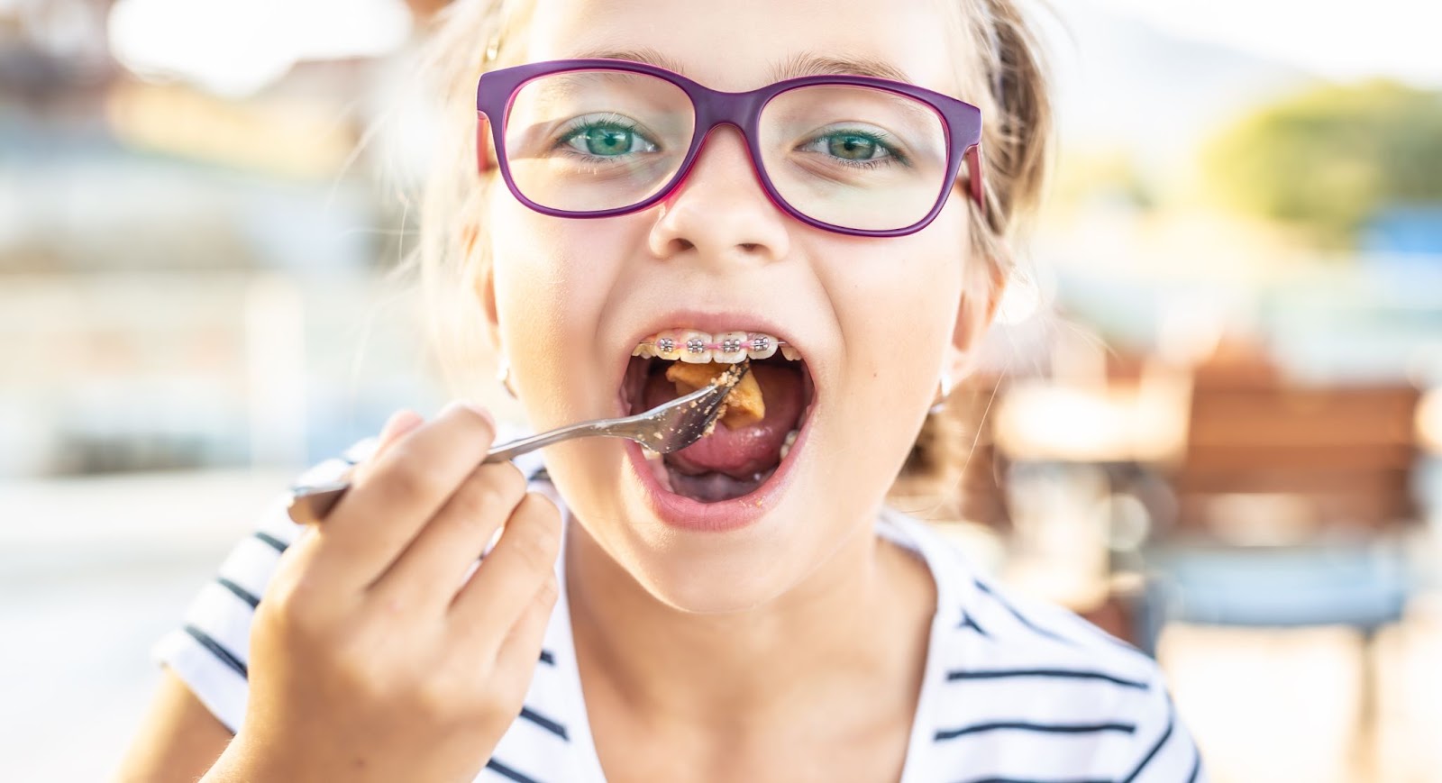 Your Guide to Healthy Dining in Cincinnati While Wearing Braces