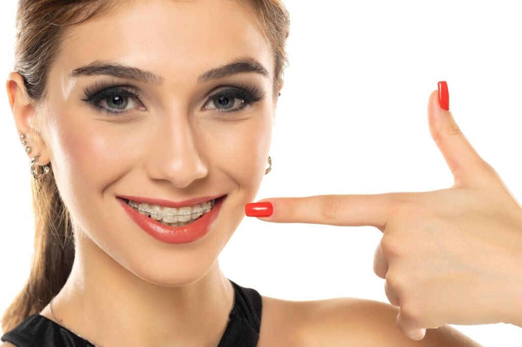 Smiling young woman with braces pointing to her teeth, representing orthodontic treatment at Thacker Orthodontics in Cincinnati.